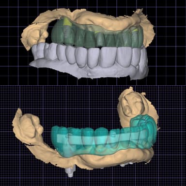 Tecnologia del Foro Inclinato