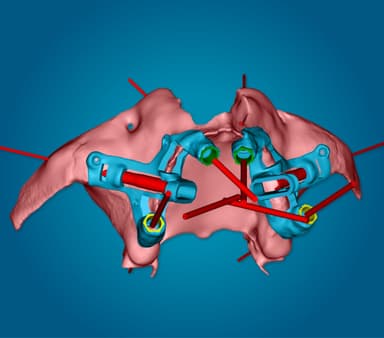 Chirurgia Guidata JD